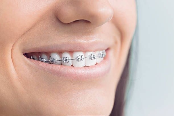 Dental X-Rays and Imaging in Red Corral, CA